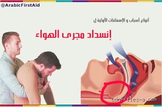 أي ضحية من ضحايا انسداد مجرى الهواء الحاد؟