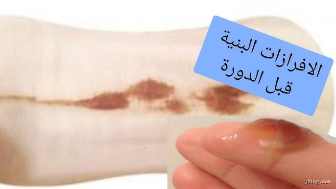 هل يجوز معاشرة الزوجة في حالة وجود إفرازات بنية؟
