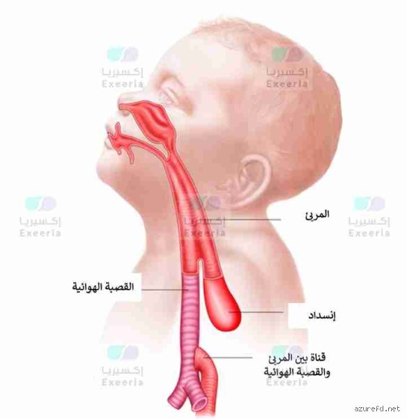 الفرق الفعلي بين انسداد مجرى الهواء الكامل والجزئي في الحالات الطارئة