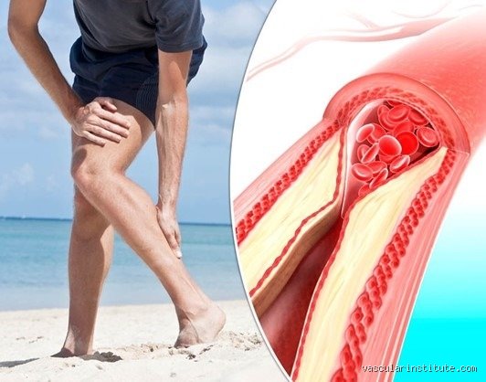 هل سبق للجزائر أن تأهلت لكأس العالم؟