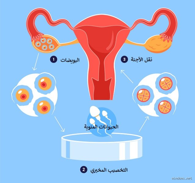كيف تعرف المرأة أن لديها عقم؟