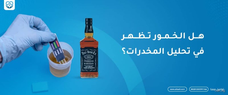 هل الخمر يظهر بالتحليل؟ دليلك الشامل حول مدة البقاء وكيفية كشفها