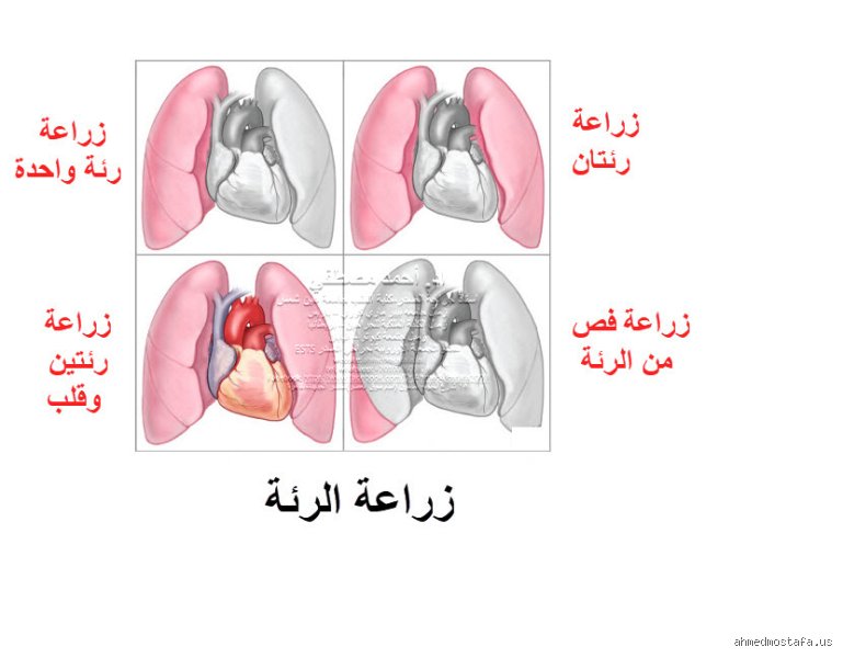 كم من الوقت يلزم حتى تتعافى الرئتان تماماً؟ الحقيقة الصادمة وراء قدرة الجسد على الإصلاح