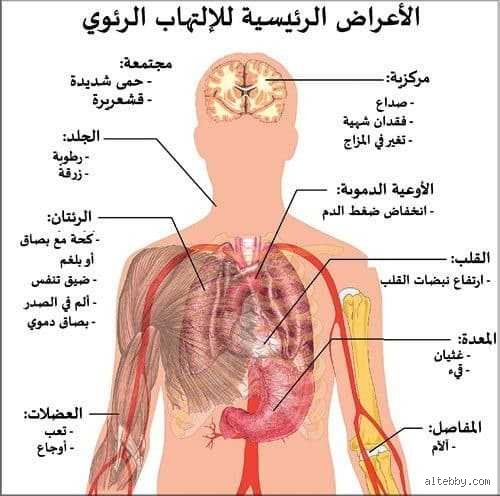 ما هي اعراض وجود بكتيريا في الرئة وكيف تفرق بينها وبين مجرد زكام عابر؟