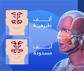 هل انسداد الأنف يسبب ضيق تنفس؟ الحقيقة الطبية وراء الخناق الصامت