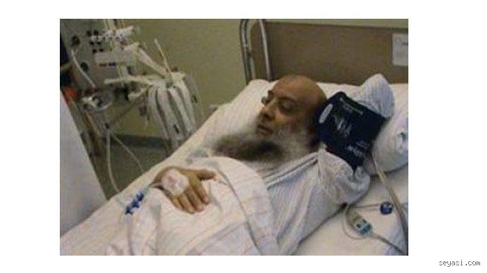 سبب بتر رجل الشيخ الحويني؟