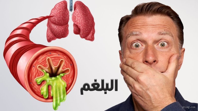 ما سبب كثرة المخاط في الحلق؟ الدليل الطبي الشامل لتفكيك هذه الأزمة الصامتة