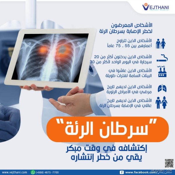 متى تظهر أعراض سرطان الرئة؟ الحقيقة المزعجة وراء الصمت الطويل للجسد