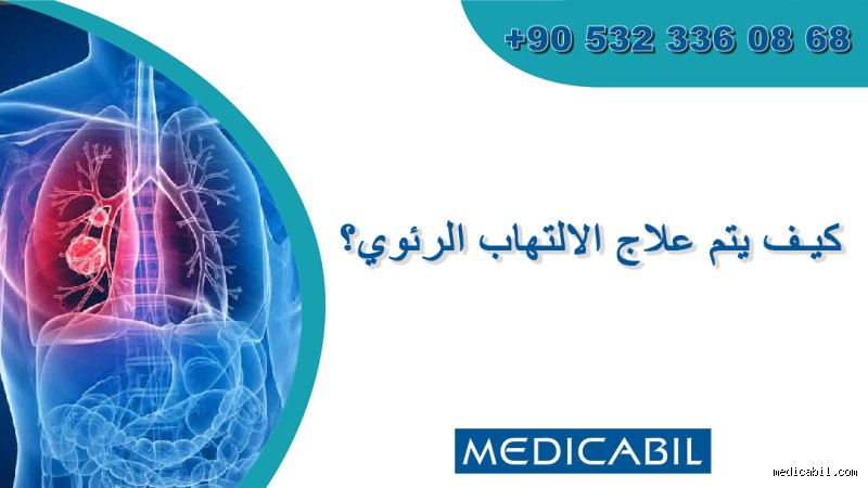 ما هو أسرع علاج لالتهاب الرئة؟