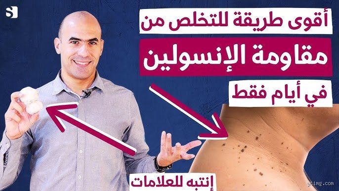 ما هي أسرع طريقة لتصبح ممرضاً؟ الإجابة المختصرة والمسار العملي