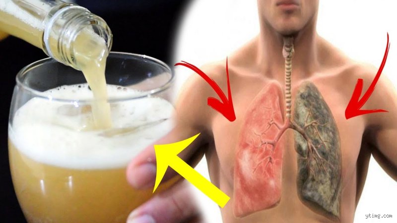 هل الزنجبيل مفيد لتنظيف الرئتين؟ الحقيقة العلمية بين هوس الخلطات ومنطق الطب
