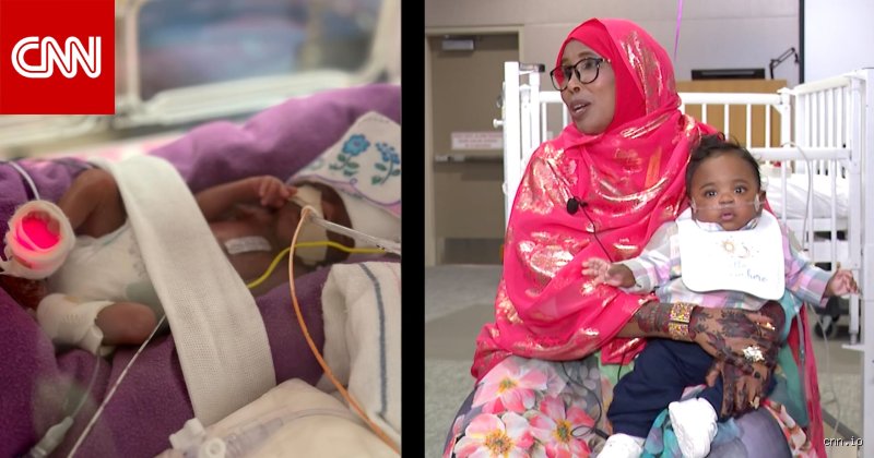 من هو أصغر طفل على وجه الأرض؟ رحلة في عالم "الخدج" والمعجزات الطبية