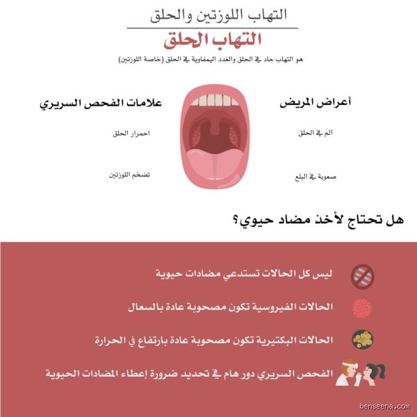 كم من الوقت سيستمر التهاب الحنجرة؟ الدليل الواقعي لعودة صوتك