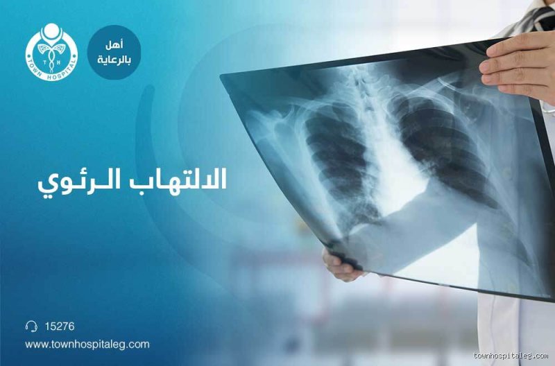 كم من الوقت يستغرق التعافي من الالتهاب الرئوي؟ دليل واقعي للشفاء