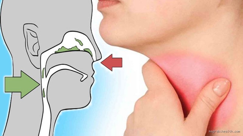 كيف تتخلص من المخاط في جسمك؟ الدليل الشامل لفك حصار البلغم