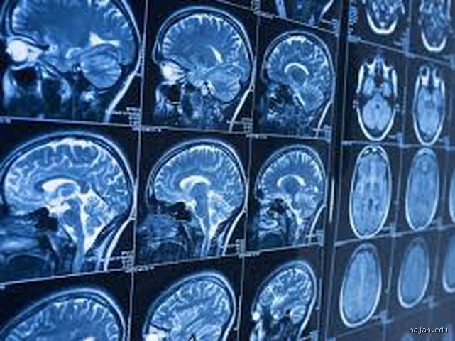 ما الذي يسبب الجريمة العنيفة؟ تفكيك خرافة الشرير الفطري