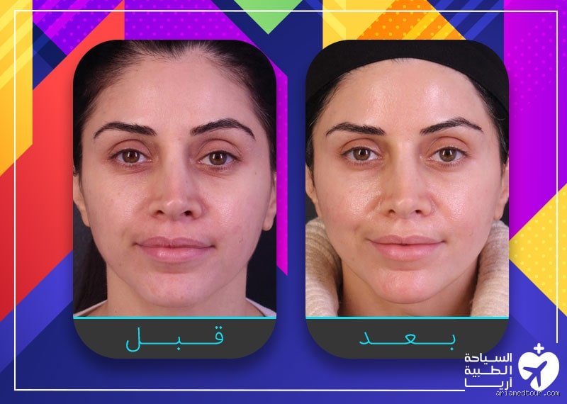ما الذي يشد البشرة فوراً؟ أسرار النتائج اللحظية بعيداً عن وعود التسويق