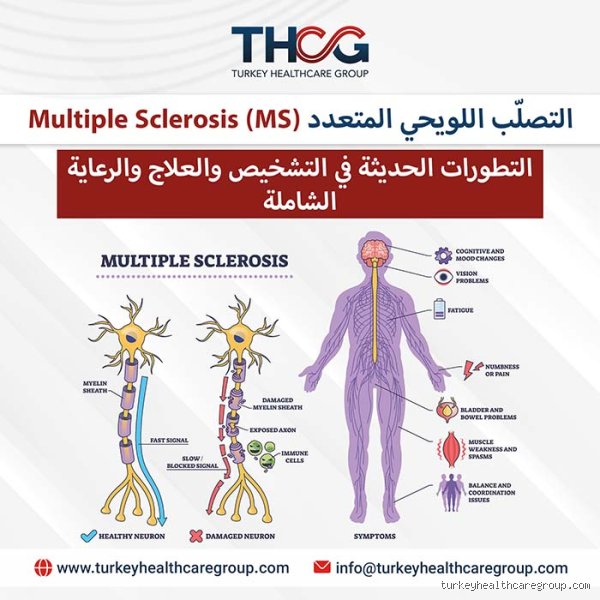 ما هو المرض الذي يبدأ بإرهاق شديد؟ الدليل الطبي الشامل لمواجهة التعب الغامض