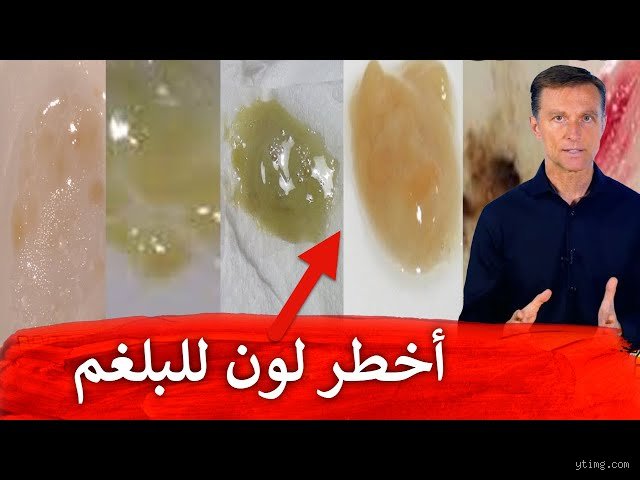 هل خروج البلغم مفيد أم ضار؟ الحقيقة التائهة بين نظافة الرئتين وإنذار المرض